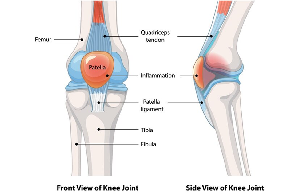 knee condition 
